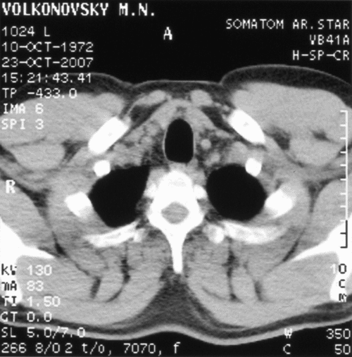 ��� ������� ������� ������